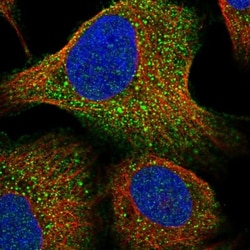 LURAP1 Antibody, Novus Biologicals 0.1mL; Unlabeled:Antibodies, Polyclonal